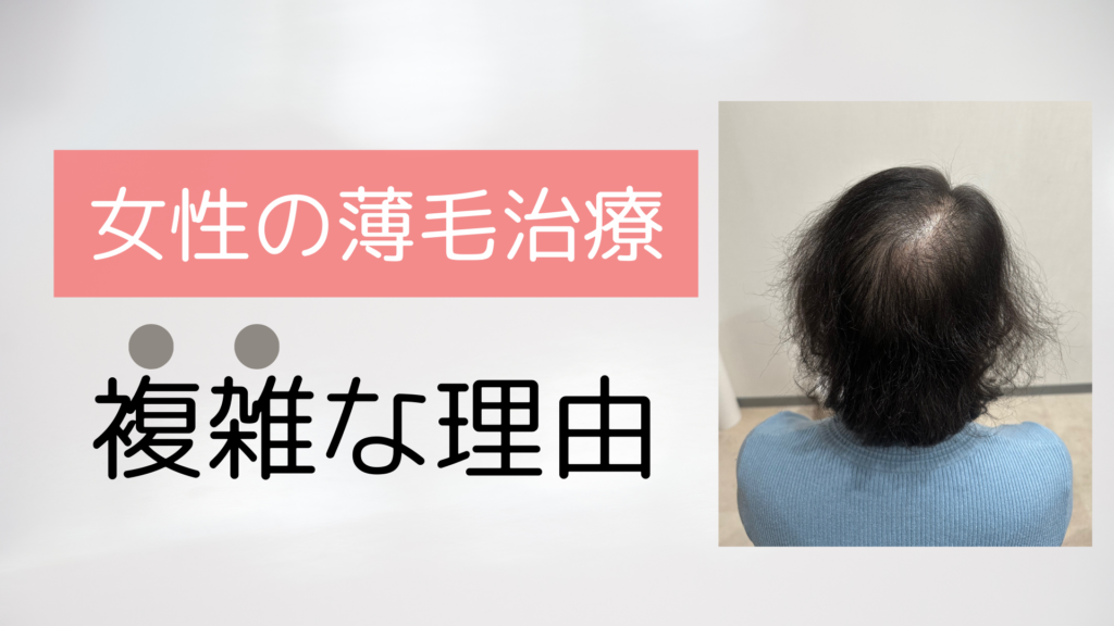 女性の薄毛治療が難しい理由