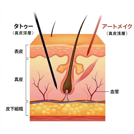 頭皮アートメイクの概要